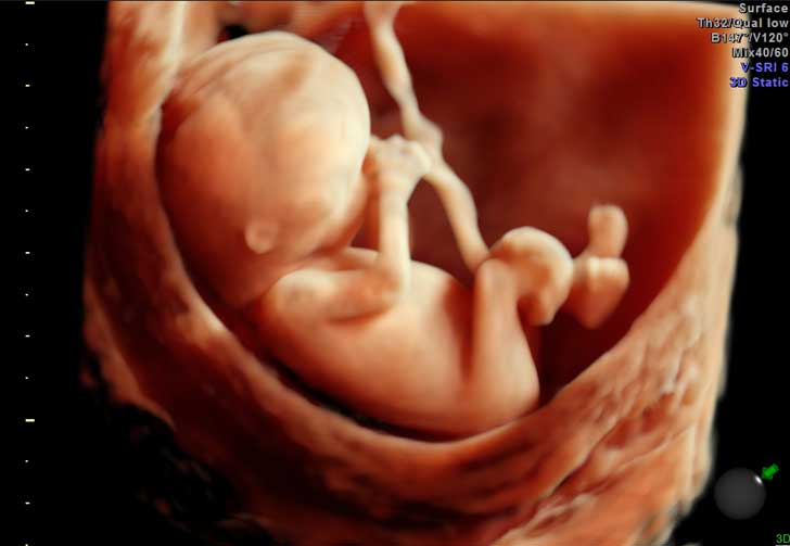 L’autopsia nelle morti fetali, perinatali e nel primo anno di vita – Milano 12 novembre 2005