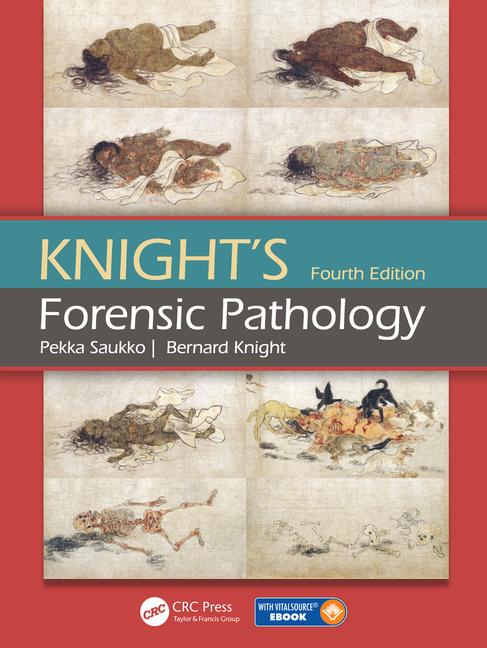 Knight’s Forensic Pathology – Saukko P, Knight  B